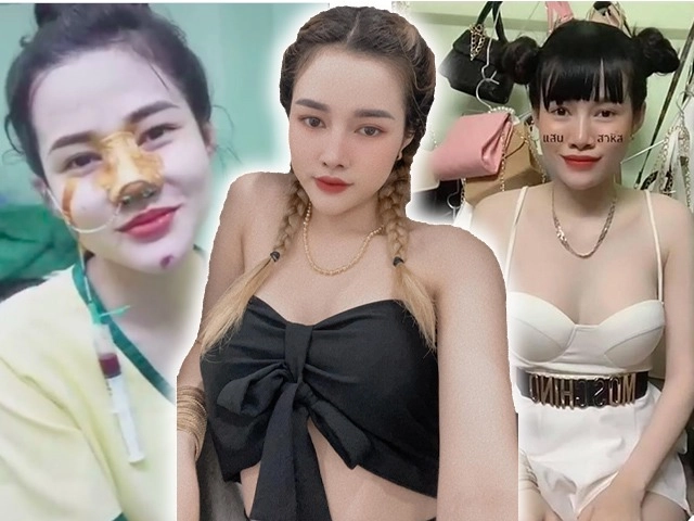 Không còn tự ti vì chiếc mũi phẫu thuật hỏng diễn viên tường vi giờ đẹp như tiên nữ - 12