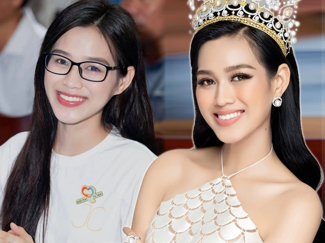 Cô gái dằn mặt người yêu cũ khi gỡ bỏ 8 chiếc răng từ vịt hoá thiên nga - 10