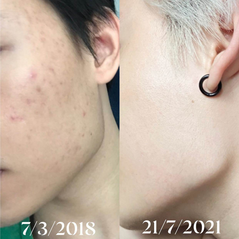 Thuý ngân sang hàn lạ nước mặt mụn biểu tình phi công trẻ ở nhà da láng như gương soi - 9