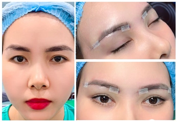 Treo cung chân mày là gì mà ai làm cũng trẻ ra chục tuổi - 2