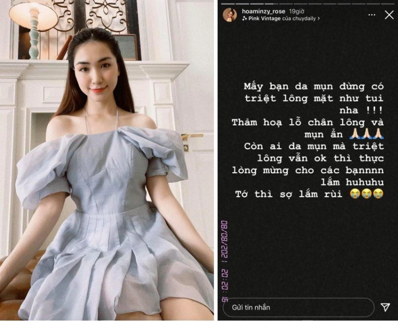 Triệt lông mặt ngờ đâu về nổi mụn hoà minzy review cực có tâm quá trình trị mụn tại gia - 1