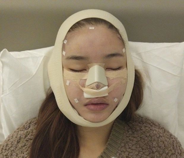 Bà xã mạc hồng quân từng gây choáng với gương mặt đầy di chứng thẩm mỹ - 6