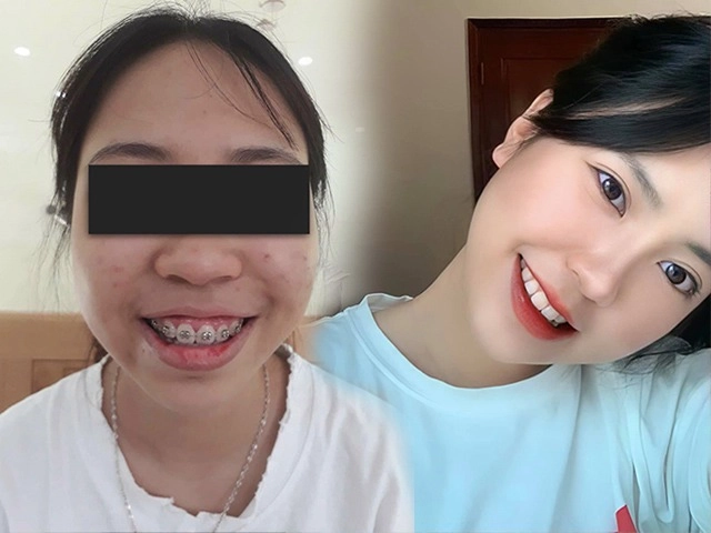 Có hay không việc uống khuẩn đường ruột mỗi sáng để chống lão hoá da - 11