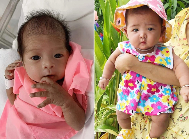 Con sinh thiếu tháng 139kg da nhăn nheo 6 tháng sau mẹ bật khóc vì may đã không vứt bỏ - 1