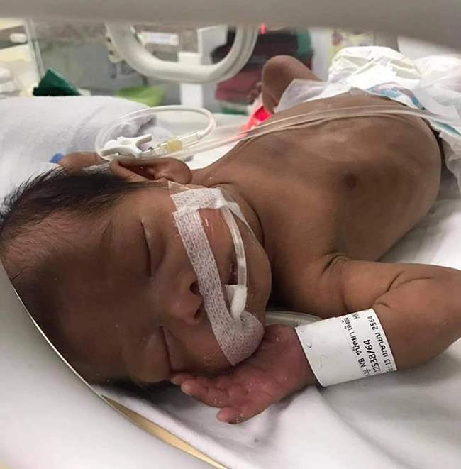 Con sinh thiếu tháng 139kg da nhăn nheo 6 tháng sau mẹ bật khóc vì may đã không vứt bỏ - 2