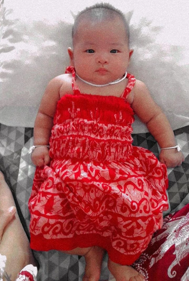 Con sinh thiếu tháng 139kg da nhăn nheo 6 tháng sau mẹ bật khóc vì may đã không vứt bỏ - 5