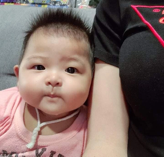 Con sinh thiếu tháng 139kg da nhăn nheo 6 tháng sau mẹ bật khóc vì may đã không vứt bỏ - 9