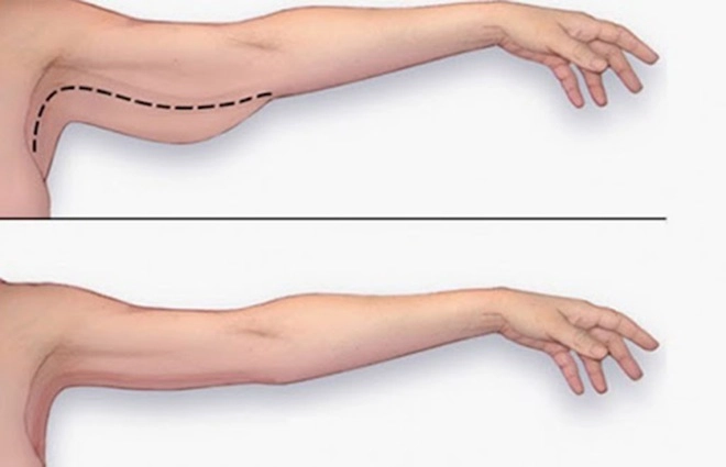 Đang già khụ hoá gái trẻ lý nhã kỳ khoe luôn vai thon khác xa body lực sĩ ngày nào - 10