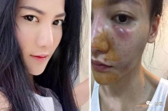 em gái hồng diễm công khai ảnh thời sinh viên khẳng định không dao kéo nhưng vẫn nhờ thủ thuật - 12
