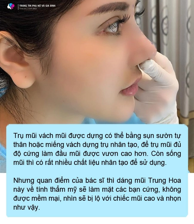 Ham chạy theo mốt mũi bay trung hoa chị em ngậm ngùi xin rút sụn - 7
