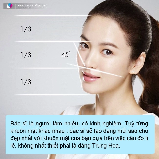 Ham chạy theo mốt mũi bay trung hoa chị em ngậm ngùi xin rút sụn - 10