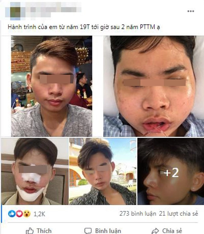 Nam thanh niên lột xác sau 2 năm gọt hàm hết hồn với chiến tích cầm về năm nào - 2