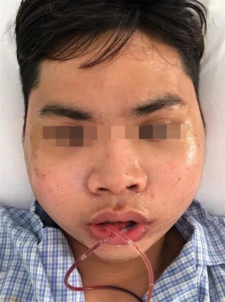 Nam thanh niên lột xác sau 2 năm gọt hàm hết hồn với chiến tích cầm về năm nào - 4