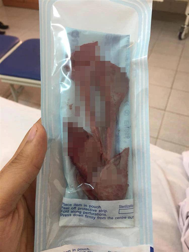 Nam thanh niên lột xác sau 2 năm gọt hàm hết hồn với chiến tích cầm về năm nào - 7