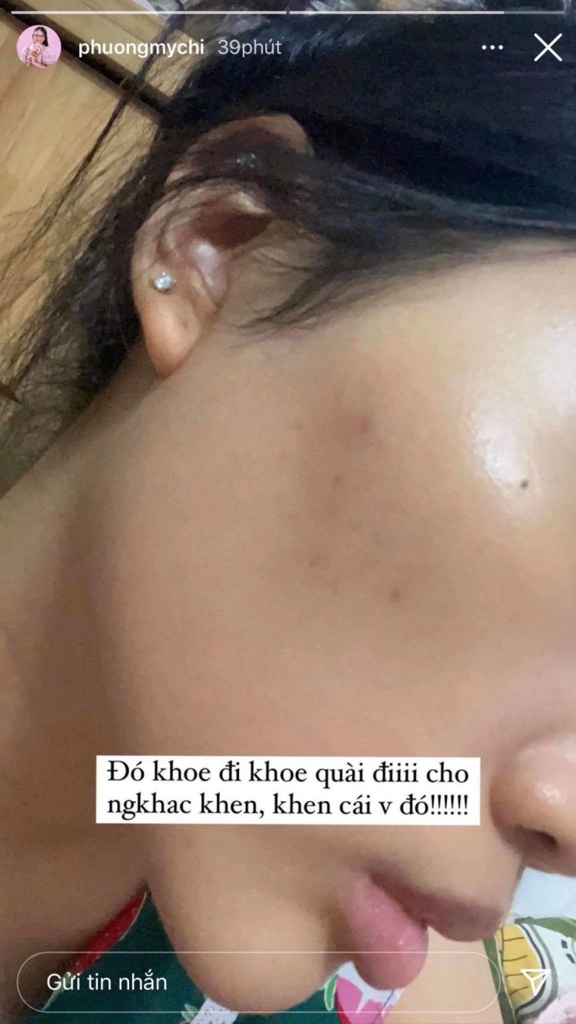 Phương mỹ chi mếu máo vì chăm da skincare cật lực nhưng skin không care nguyên nhân ai cũng mắc - 2