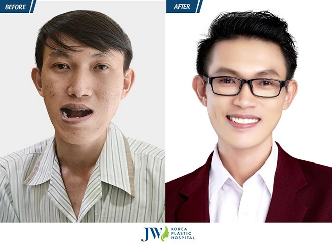 Tạm dừng showbiz tú vi - văn anh bất ngờ trở lại cùng nhan sắc mới khởi đầu mới - 4