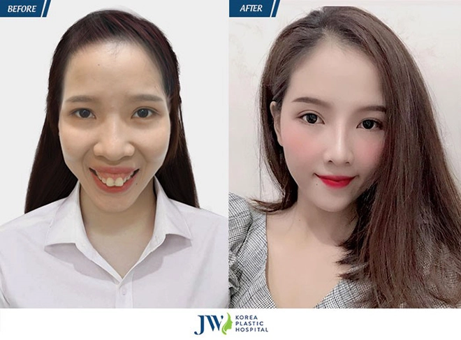 Tạm dừng showbiz tú vi - văn anh bất ngờ trở lại cùng nhan sắc mới khởi đầu mới - 5