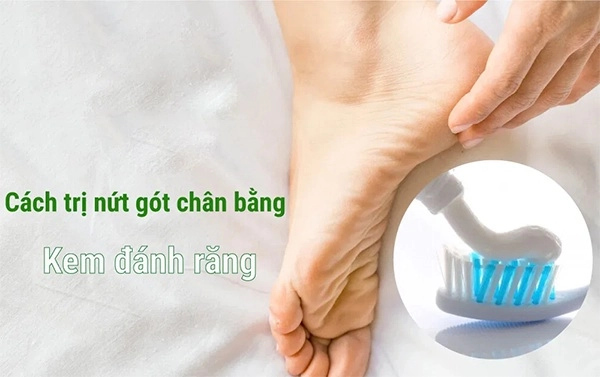 10 cách trị nứt gót chân tại nhà tự nhiên an toàn hiệu quả nhanh nhất - 2