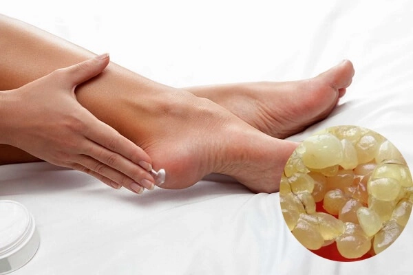 10 cách trị nứt gót chân tại nhà tự nhiên an toàn hiệu quả nhanh nhất - 5