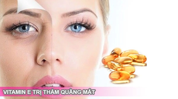 10 cách trị thâm mắt tại nhà an toàn hiệu quả từ nguyên liệu tự nhiên - 6