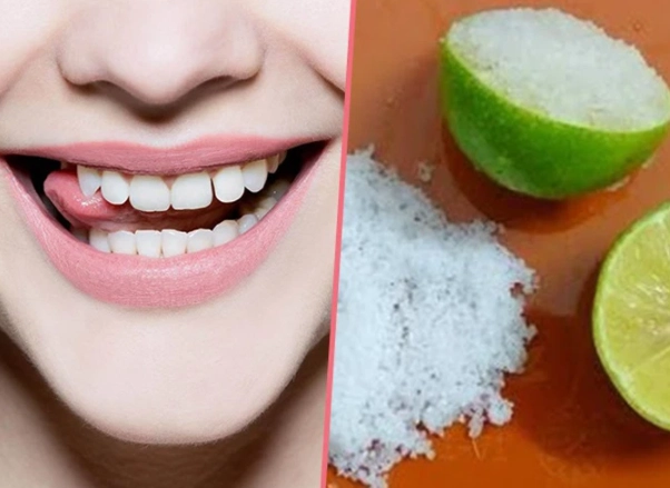 8 cách làm trắng răng bị vàng ố tại nhà an toàn hiệu quả - 2