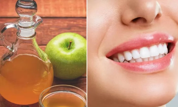 8 cách làm trắng răng bị vàng ố tại nhà an toàn hiệu quả - 10