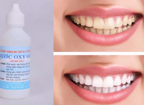 8 cách làm trắng răng bị vàng ố tại nhà an toàn hiệu quả - 13