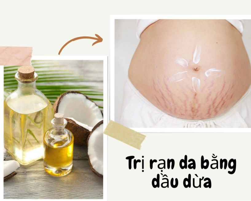 Bật mí cách dưỡng da cho bà bầu căng mịn đến gái còn son cũng chịu lép vế - 3