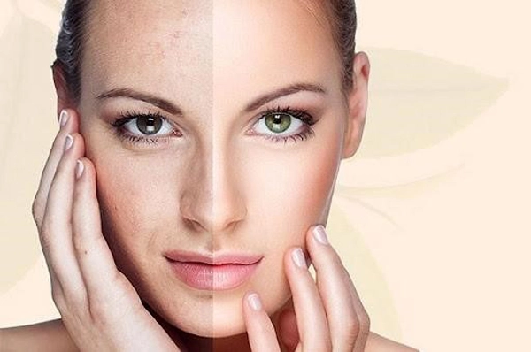Chọn mua mỹ phẩm ở đâu để không sợ nhầm hàng nhái hàng giả - 3