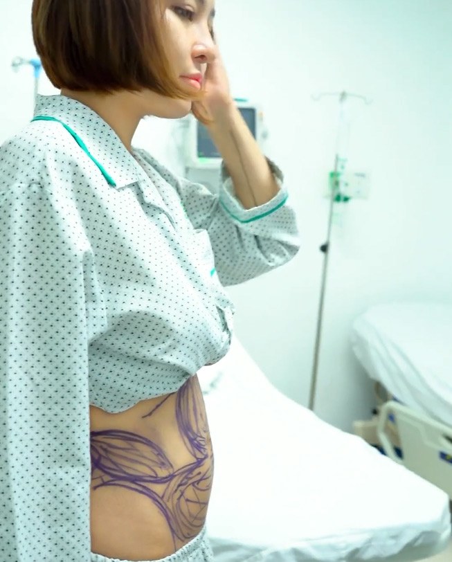 Hot girl trâm anh sau hút mỡ bụng tích cực khoe thân với đồ kiệm vải - 3