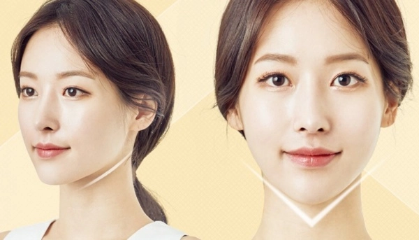Muốn tiêm filler làm đẹp nàng nên nắm những lưu ý sau để tránh tiền mất tật mang - 8