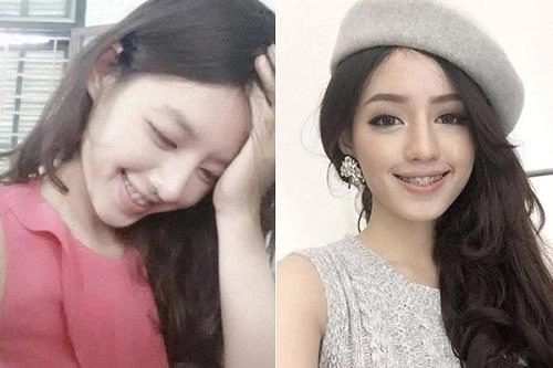 Răng sắt thì mặc răng sắt hoàng thùy khánh linh vẫn tự tin khoe nụ cười tỏa nắng - 6