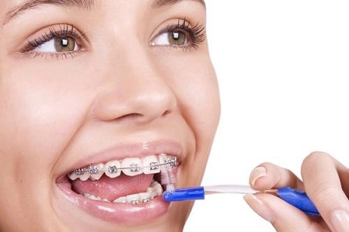 Răng sắt thì mặc răng sắt hoàng thùy khánh linh vẫn tự tin khoe nụ cười tỏa nắng - 8
