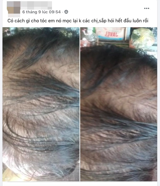 Rẻ-đẹp-dễ đến mùa rụng tóc cô nàng ủ tóc chỉ bằng đồ bếp tóc con mọc rậm như cỏ - 2