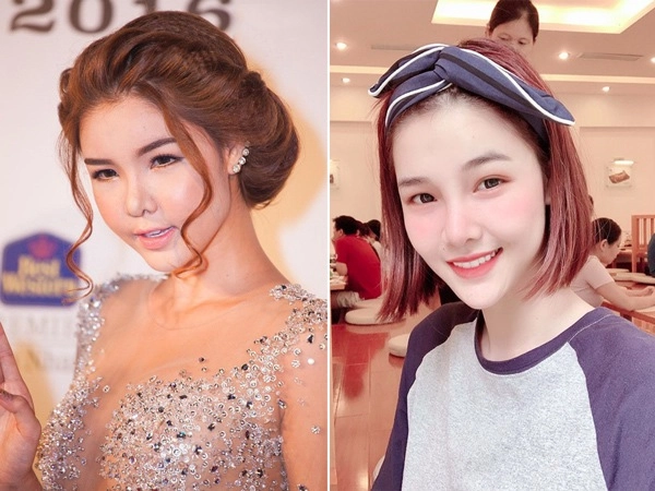 Trước khi xinh đẹp diệp lâm anh từng làm công chúng không nhận ra vì mặt sưng phù - 21