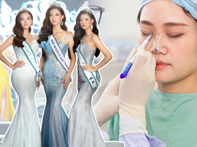Trước khi xinh đẹp diệp lâm anh từng làm công chúng không nhận ra vì mặt sưng phù - 30