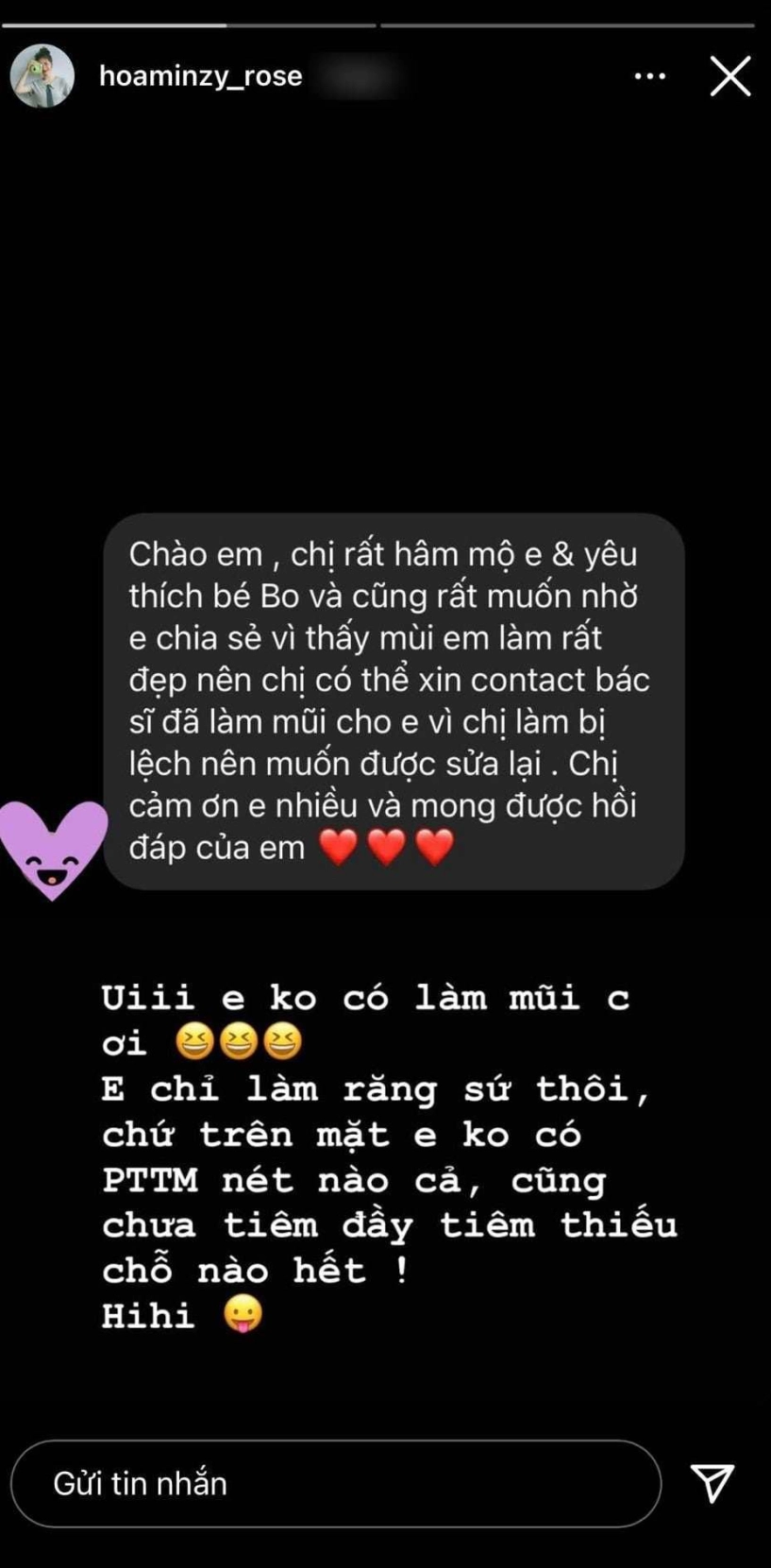 Bị hỏi địa chỉ làm mũi hoà minzy công khai luôn bộ phận đã sửa trên gương mặt - 1