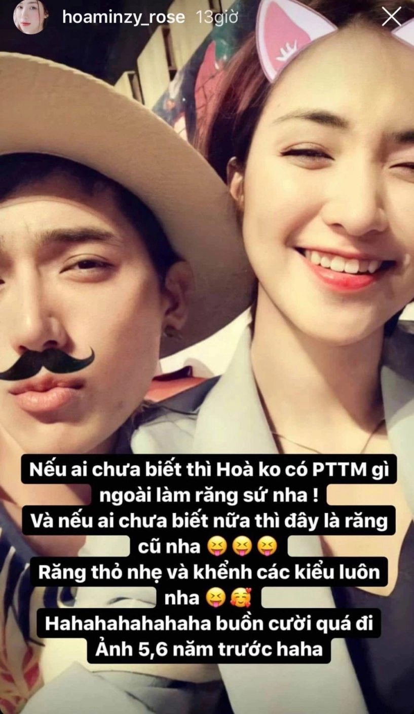 Bị hỏi địa chỉ làm mũi hoà minzy công khai luôn bộ phận đã sửa trên gương mặt - 2