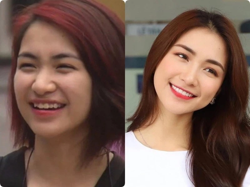 Bị hỏi địa chỉ làm mũi hoà minzy công khai luôn bộ phận đã sửa trên gương mặt - 4