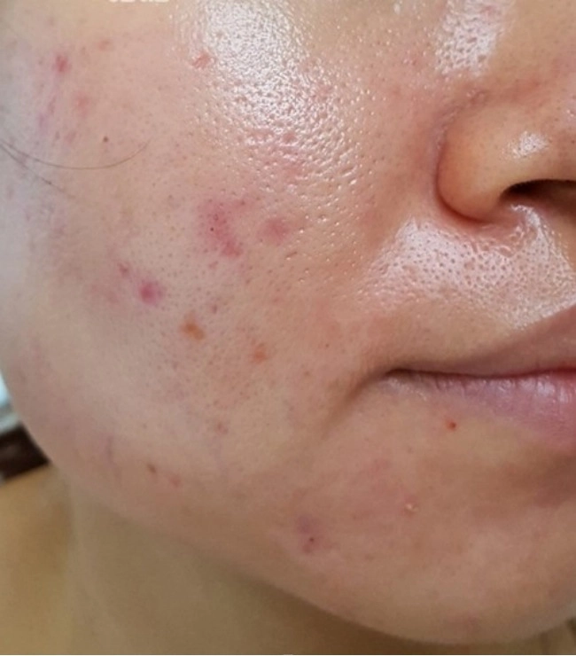 Giấy thấm dầu có làm tăng tiết bã nhờn như lời đồn và cách dùng đúng ít ai biết - 2