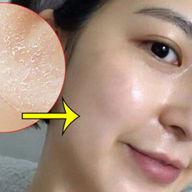 Hòa minzy khóc ròng khi mặt bong tróc từng mảng nhăn nheo như bà già - 8