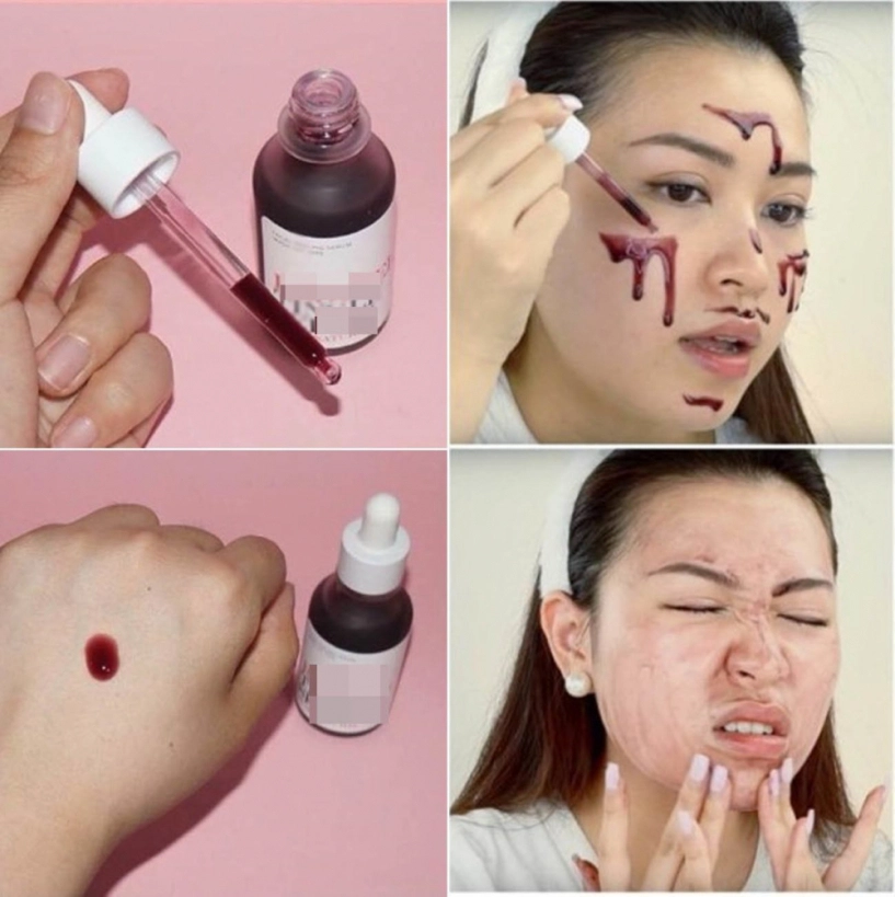 Hòa minzy khóc ròng khi mặt bong tróc từng mảng nhăn nheo như bà già - 9