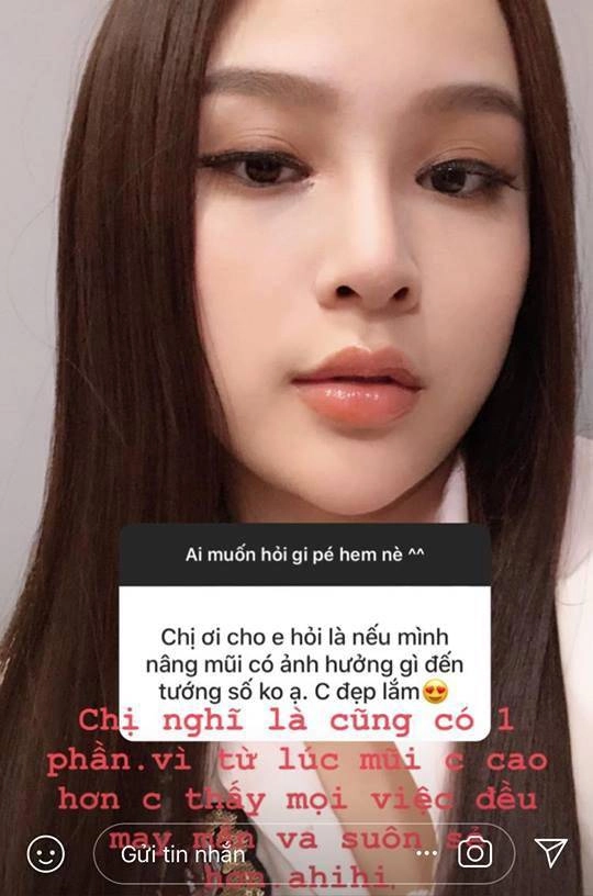 Huyền baby tiêm filler lên mũi cằm thon gọn hàm để trở nên hoàn mỹ - 5