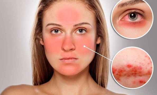Kem trộn làm trắng da thế nào và hậu quả khôn lường chị em nên biết - 3