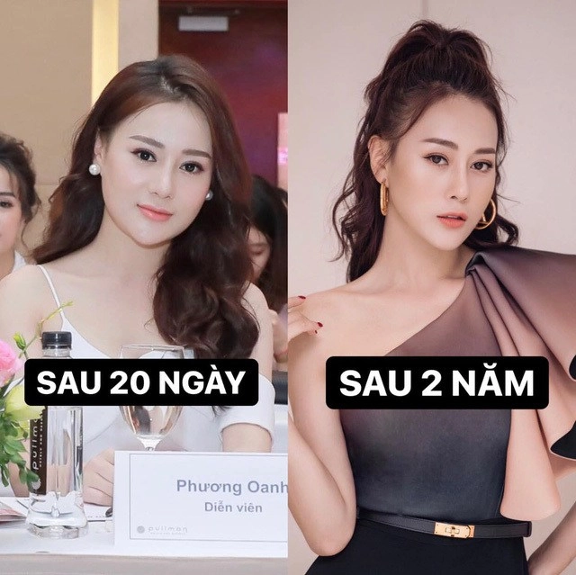 Khoe ảnh thẻ thời tiểu học phương oanh giờ sửa gần hết gương mặt mà nhan sắc vẫn vẹn nguyên - 7