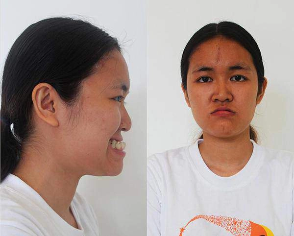 Nhung nguoi phu nu mang mat quy hoa thien than nho phau thuat tham my - 20