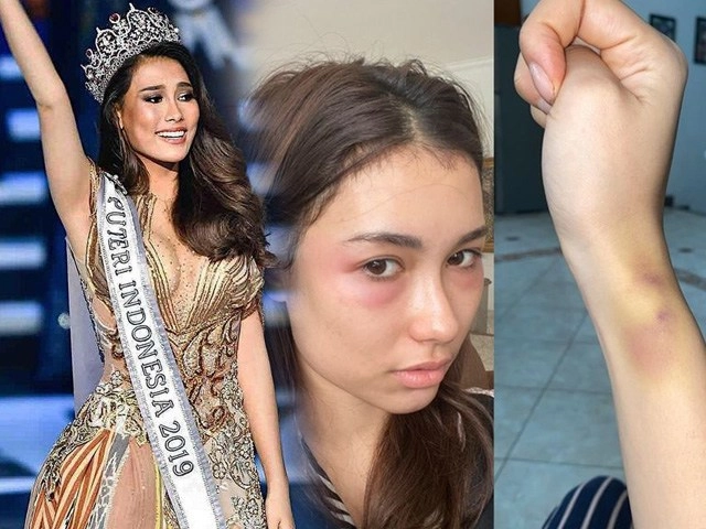 Dân mạng rần rần xu hướng check mũi pha-ke nhìn tấu hài nhưng độ chuẩn khỏi bàn - 8