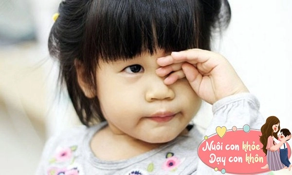 Trẻ khô mắt sức đề kháng kém vì thiếu vitamin a bác sĩ khoa nhi tư vấn cách bổ sung - 3