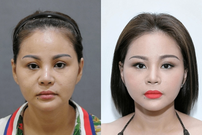 Vbiz có 2 bà hoàng dao kéo người làm đẹp từ năm 15 tuổi người sửa bộ phận khó tin - 9