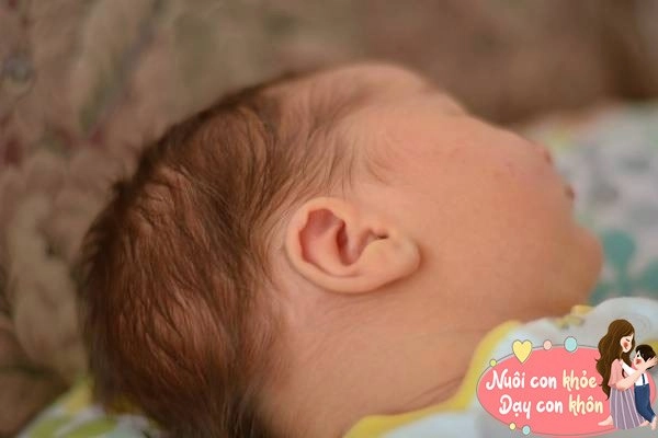 Bật mí những bộ phận trẻ sơ sinh phải xấu chứng tỏ con khỏe mạnh mẹ chớ vội buồn - 4